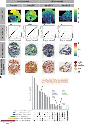 IFI27 transcription is an early predictor for COVID-19 outcomes, a multi-cohort observational study